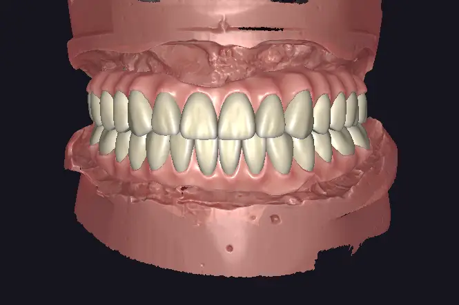 20260711160932